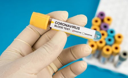 Найбільше захворіли на коронавірус в Україні люди віком від 30 до 49 років