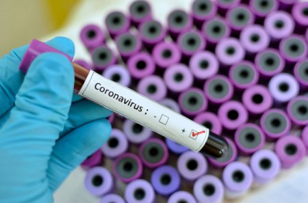 Ріст захворюваності - 100 ужгородців  мають підтверджені діагнози коронаврусної інфекції
