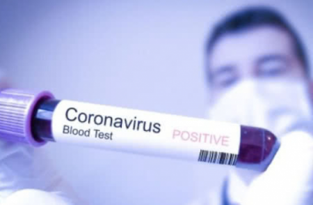 В Україні виявили 8617 хворих на коронавірус