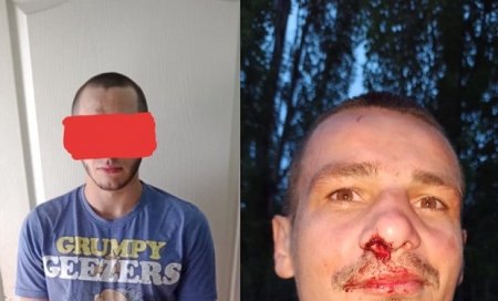 В Ужгороді хулігани побили голову Федерації інвалідів опорно-рухового апарату
