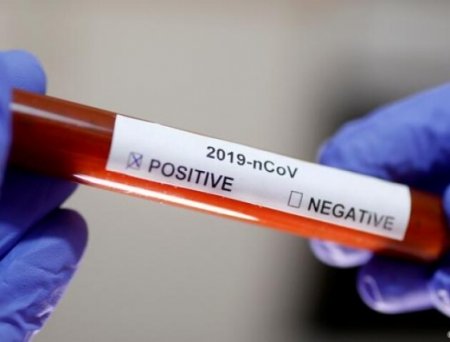 За минулу добу на Закарпатті у 89 пацієнтів підтверджено коронавірус