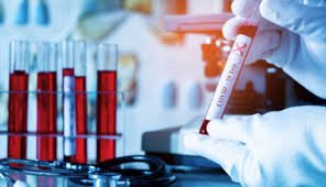 Інформація про захворюваність на COVID-19 в Ужгороді