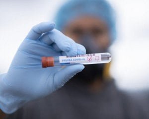 За останню добу в Україні виявили 6624 нових хворих на коронавірус