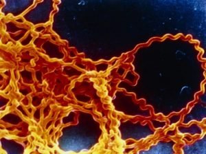 На Закарпатті від небезпечного інфекційного захворювання померли вже троє людей