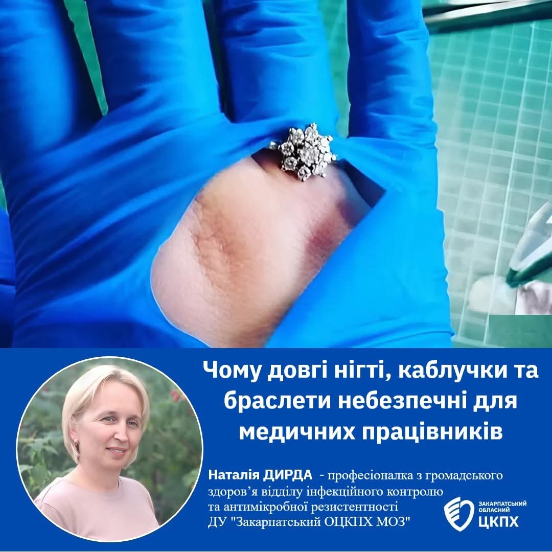 Руки вбивці: чому ваш улюблений манікюр може коштувати пацієнту життя?