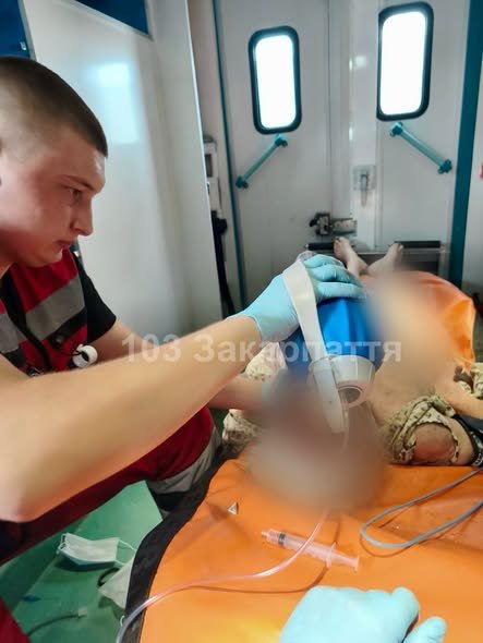 Пожежа в Мукачеві: один чоловік загинув, лікарі рятують жінку