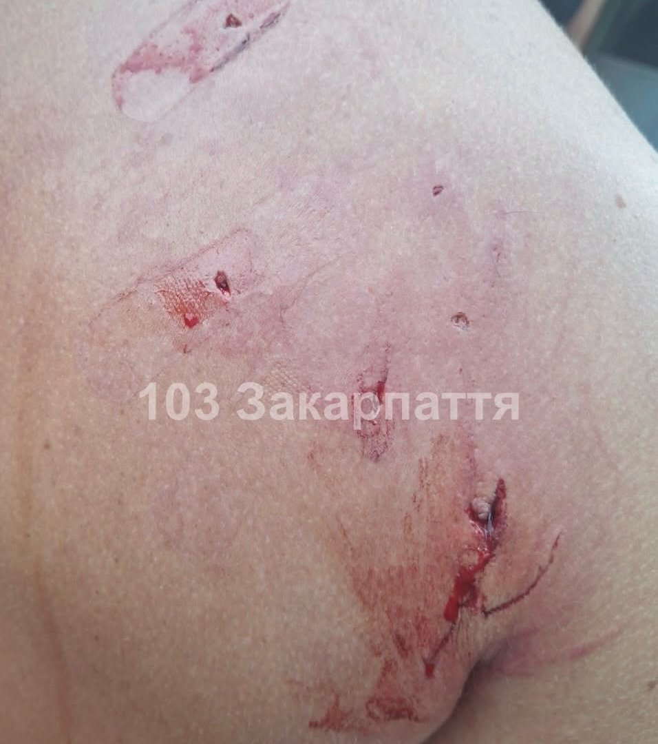 Напад у власному домі: в Ужгороді домашній улюбленець  понівечив двох господарів