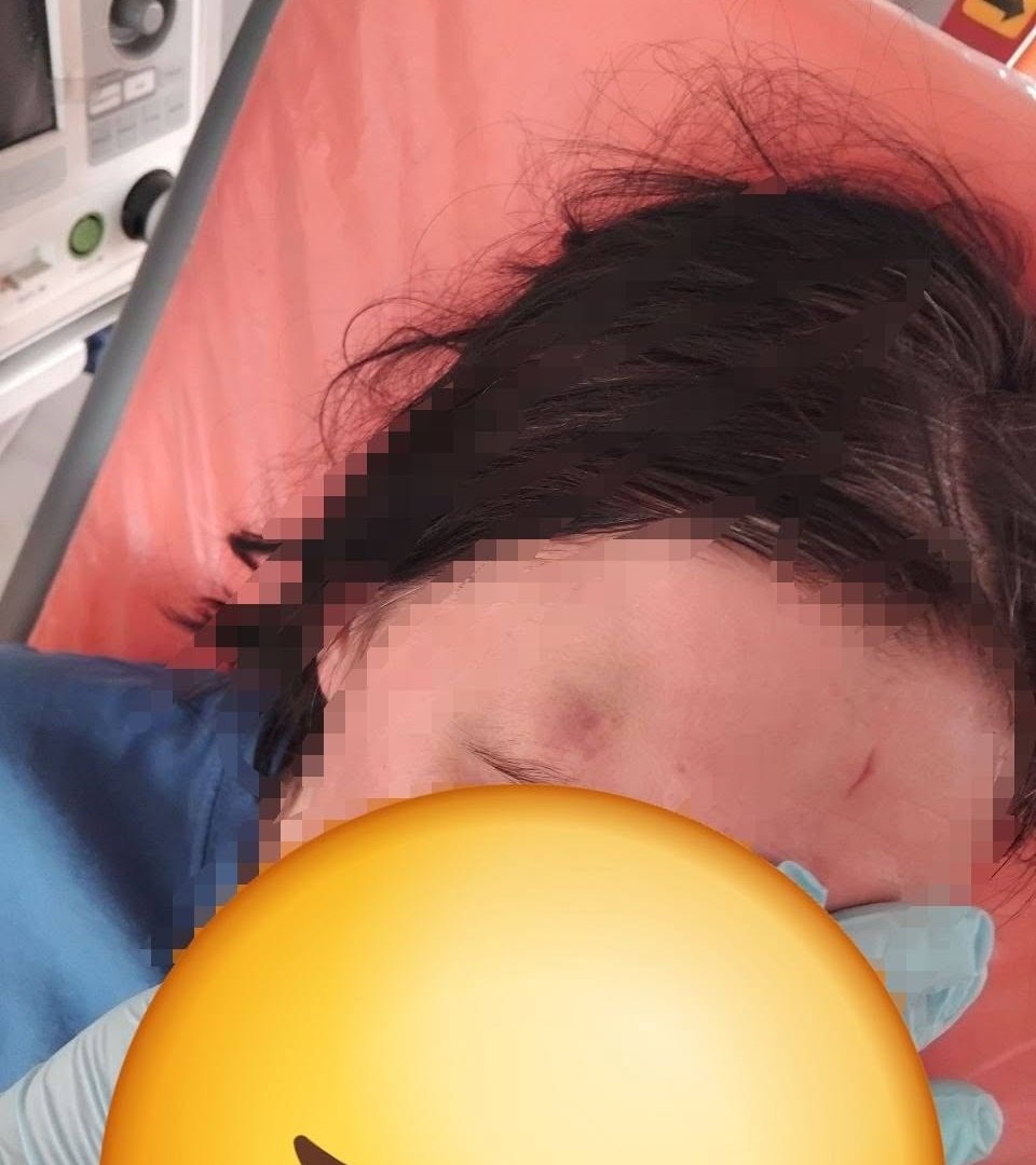 Підвищений тиск виявився жорстоким побиттям: у Мукачеві медики швидкої врятували жертву домашнього насильства